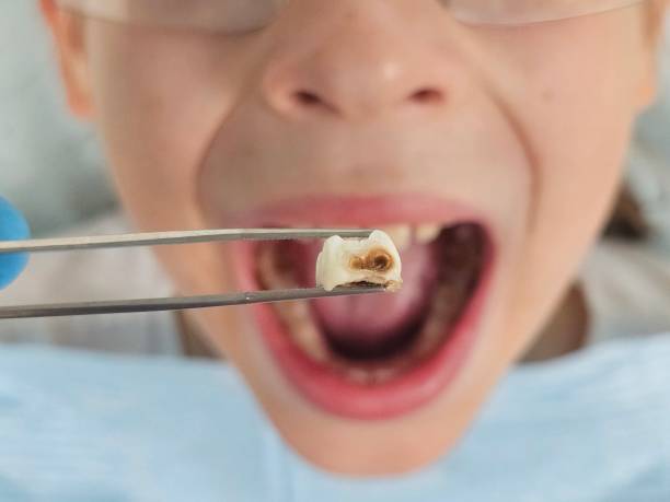 Best Pediatric Emergency Dentist in Sun City Center, FL